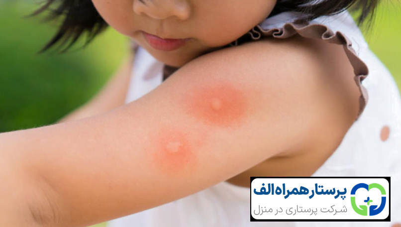 محافظت از کودکان در مقابل تب دنگی 30 پرستار همراه الف