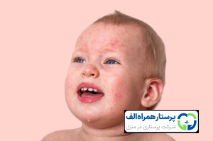 وبلاگ 36 پرستار همراه الف